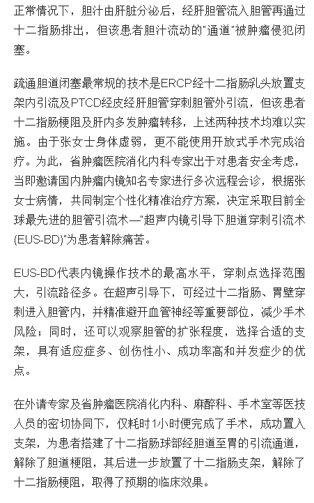 《海南日報》：海南實施首例超聲內(nèi)鏡引導(dǎo)下膽道穿刺引流術(shù)2.png